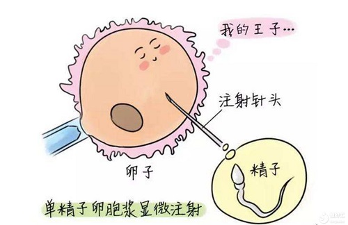 试管婴儿费用总共多少？三代试管费用会增加吗？