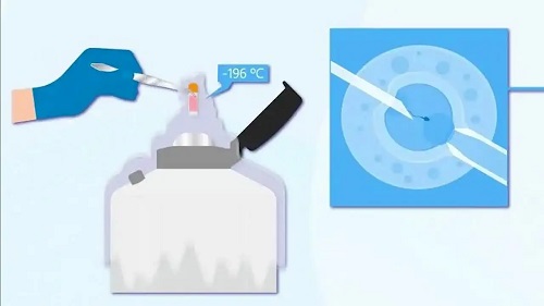 2021做试管最好的私立医院是哪家？