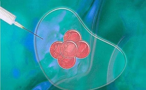 试管婴儿胚胎等级怎么分？什么是养囊？