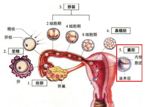 做一次试管婴儿需要花费多少钱