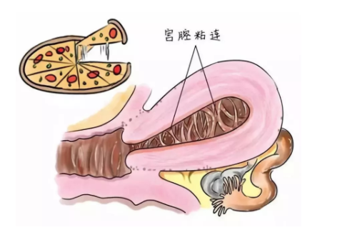 现在做一次试管多少钱