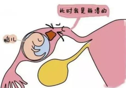 泰国试管婴儿过程？